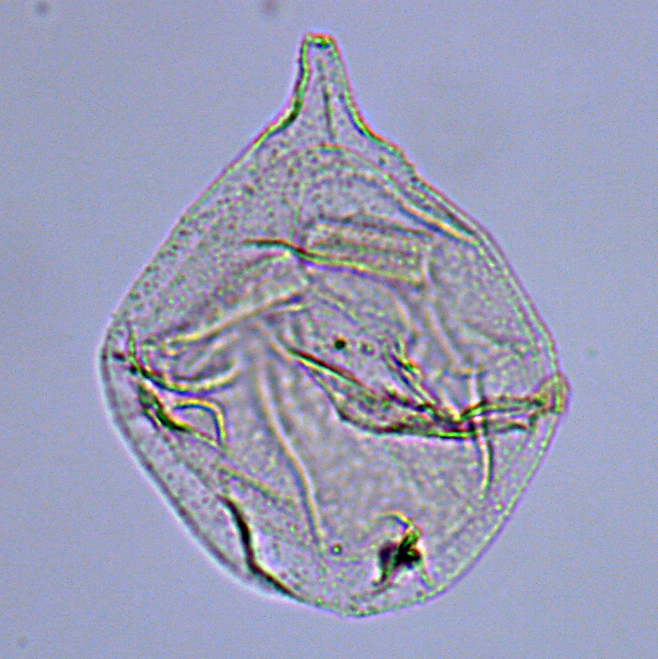 Isabelidinium acuminatum, U1581-23R-5W, 101-106, sl. 1, Q20-1, foto-b.jpg